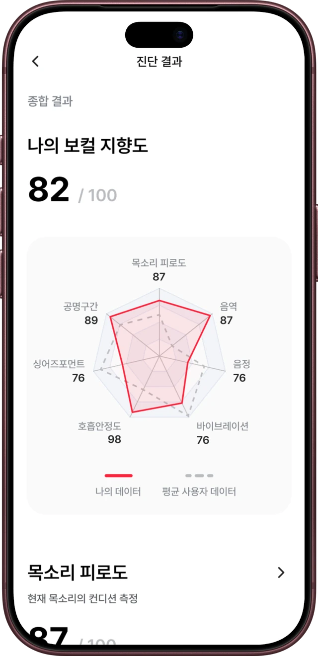 MUZLY 진단 결과 화면: 나의 보컬 지향도 82/100, 7가지 특징 레이더 차트